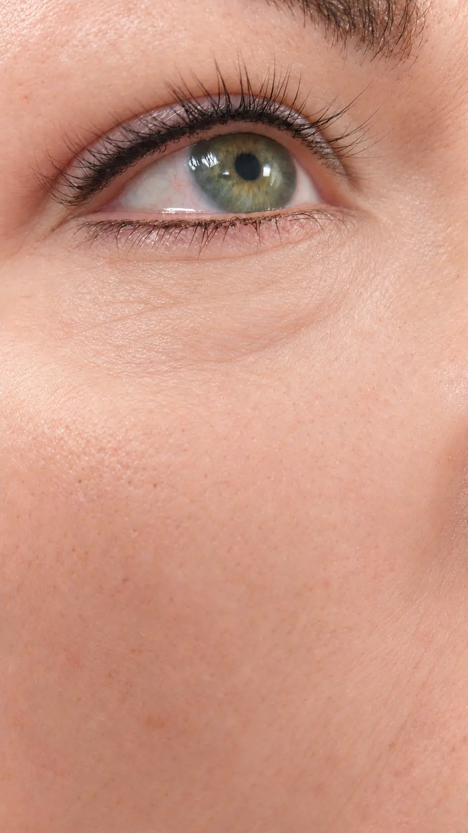 Nahaufnahme einer Wimpernkranzverdichtung am Auge